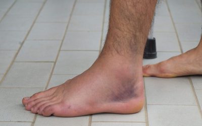 Recuperação eficiente de entorses de tornozelo