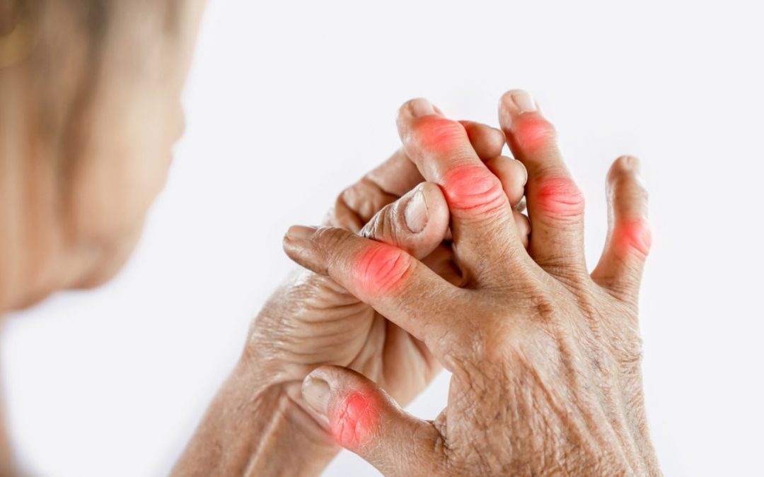Fisioterapia para Artrose e Artrite no Paraíso