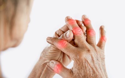 Fisioterapia para Artrose e Artrite no Paraíso: Alívio Garantido