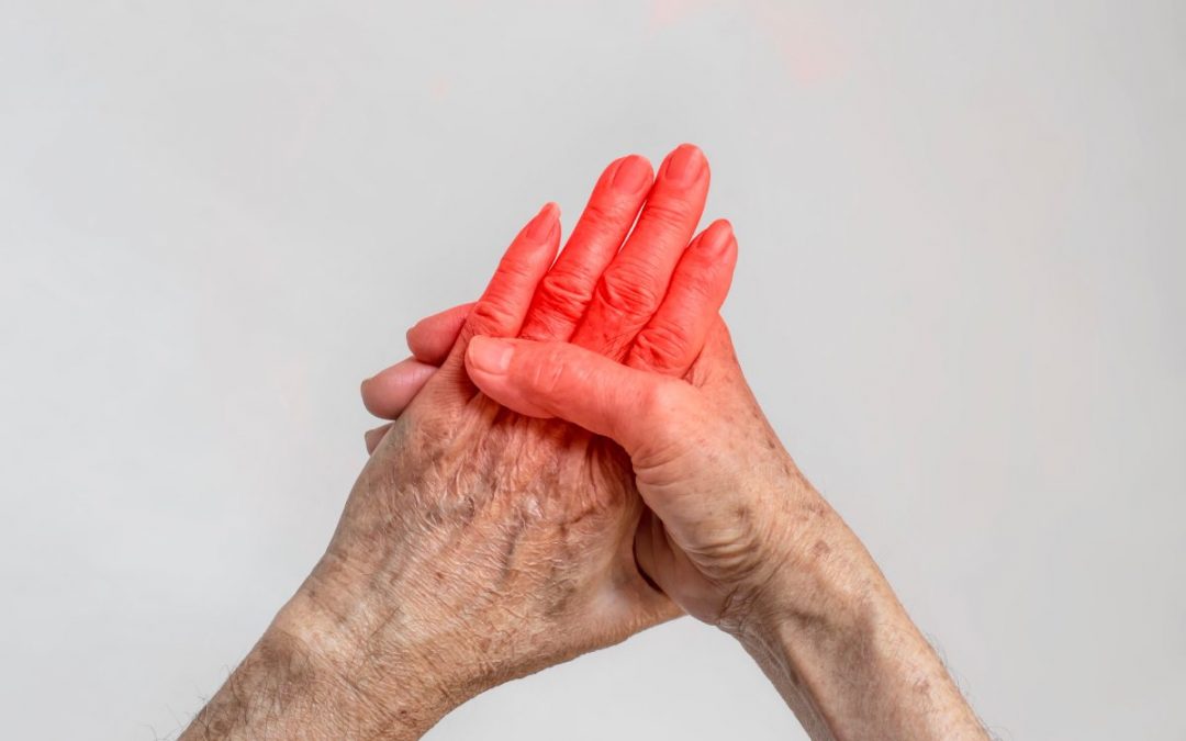 Fisioterapia para Artrose e Artrite em Pinheiros