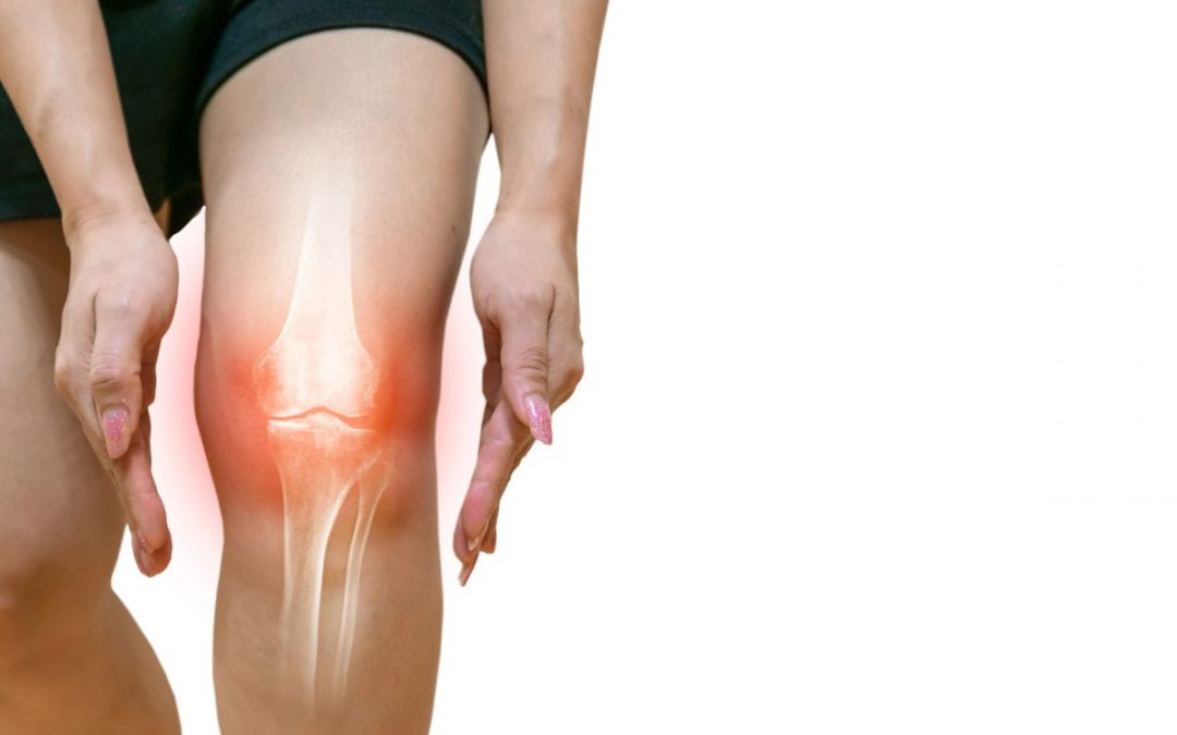 Fisioterapia para Artrose e Artrite em Moema