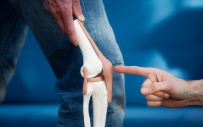 Fisioterapia para Condromalácia Patelar em Moema: Alívio Rápido