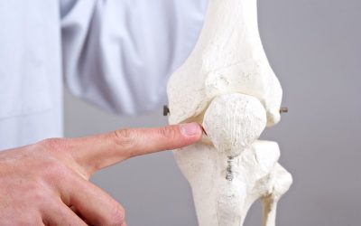 Fisioterapia para Condromalácia Patelar em Pinheiros