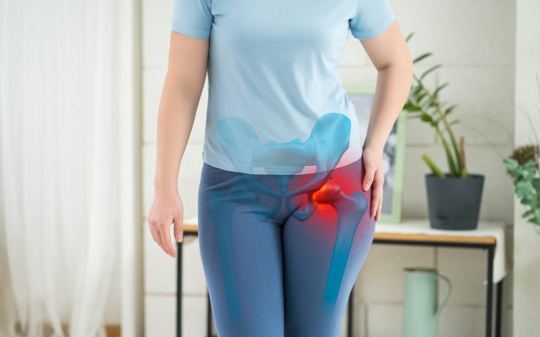 Recuperação após cirurgia de quadril