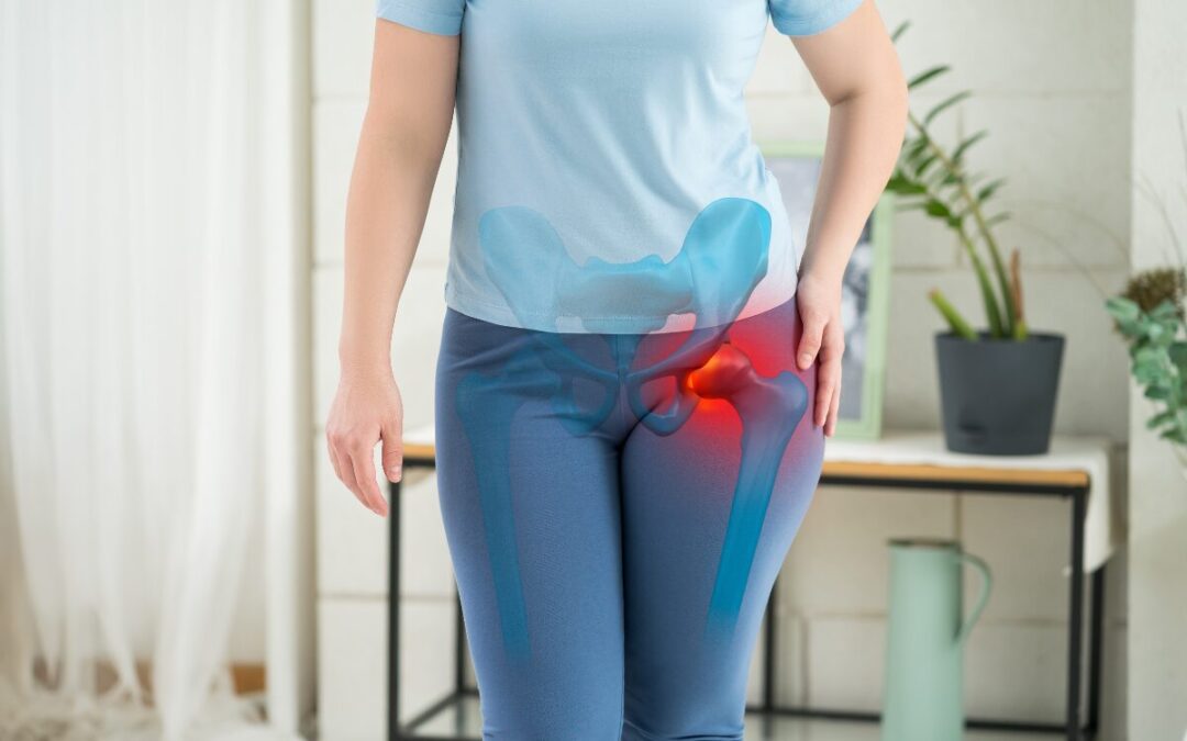 exercícios para artrose no quadril