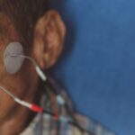 FES na Paralisia Facial